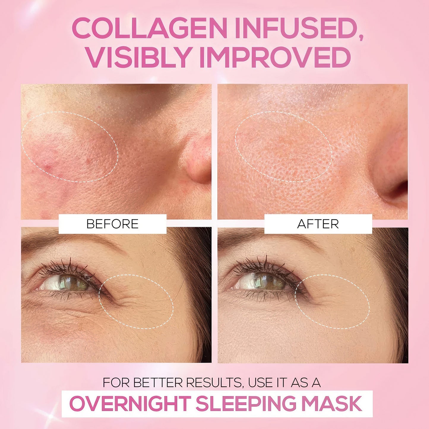 RENEE Pink Therapy Hydrolyzed Collagen Jelly Cream For Anti-Aging & Hydrated Skin