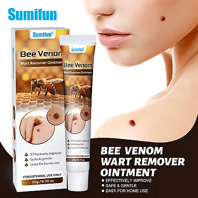 Bee Venom Wart Removal Cream